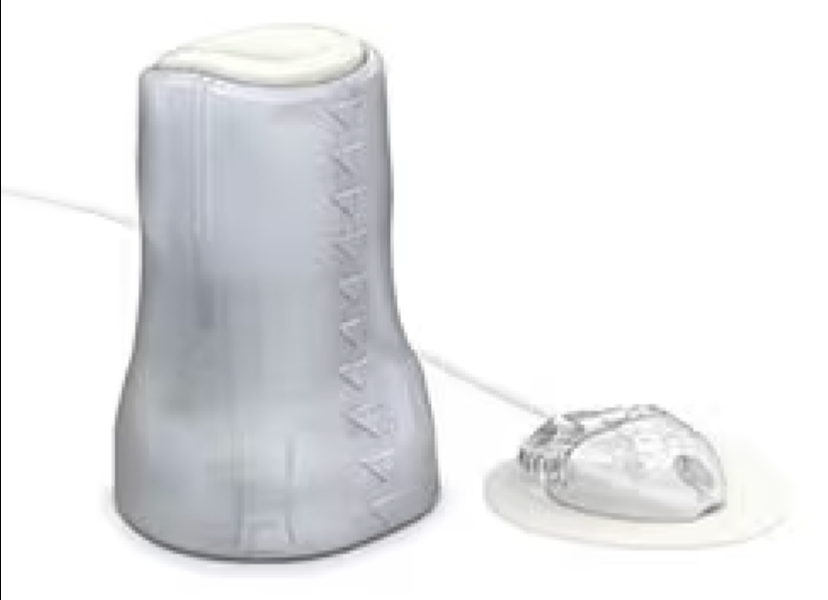 Medtronic MiniMed Mio Advance SINGLE Sensor | 6mm/43" (MMT-213A) Early Expiration